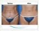 Slider image (5) Aesthetic Cosmetic Plastic Surgery Center Bolivia - SensualBodyDream
